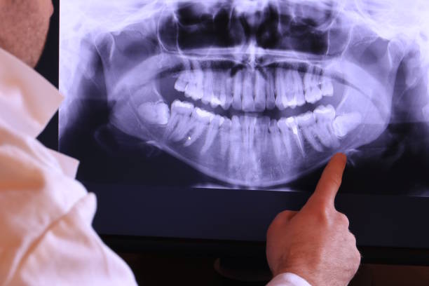 Best Pediatric Emergency Dentist in Cattaraugus, NY